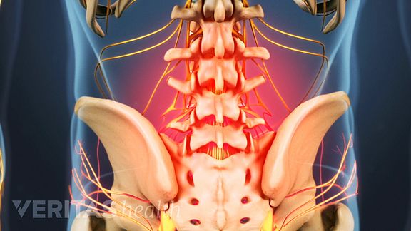 bottom spine pain 3g comic strip